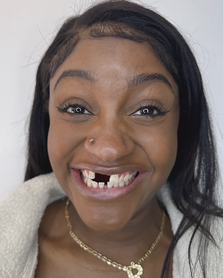 The patient before treatment